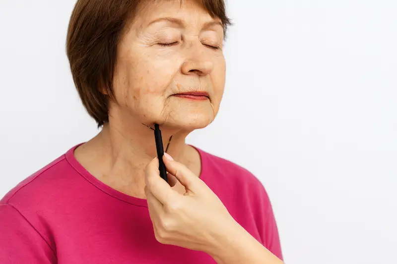 Elderly woman with closed eyes having her jawline marked with a black pen during a consultation, symbolizing deep plane facelift recovery time.