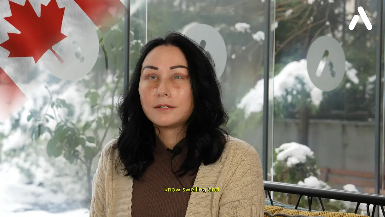 Woman sharing her deep plane facelift recovery experience and swelling process, featuring a Canadian flag overlay.