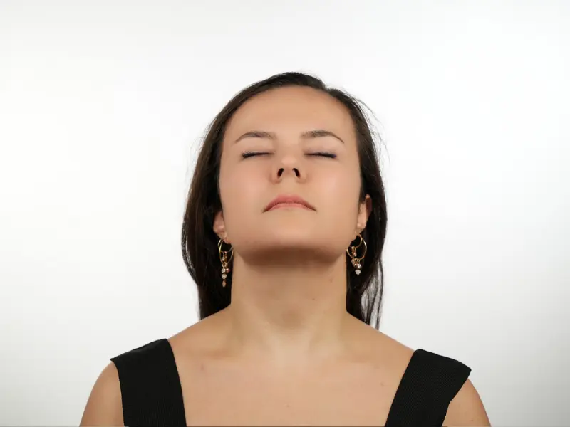The female patient undergoing a Twilight facelift in Turkey, showcasing natural mid-face rejuvenation and a sharply defined jawline.