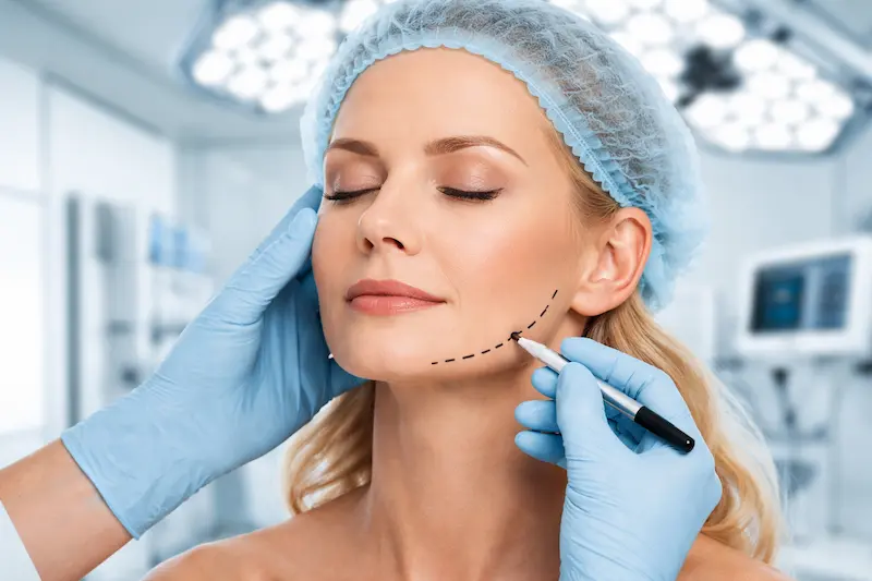 Awake mini facelift procedure under local anaesthesia, showing precise jawline marking in a modern surgical clinic setting.