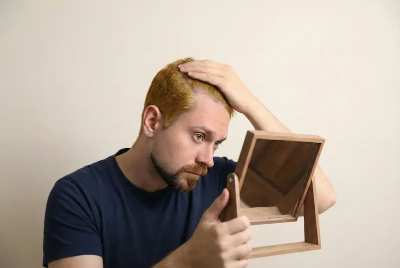 Man examining his thinning hair in a mirror while researching dhi vs fue hair transplant options