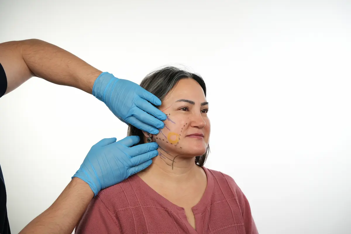 Clinician in blue gloves assessing a patient’s face with facelift planning markings on the cheek and neck.