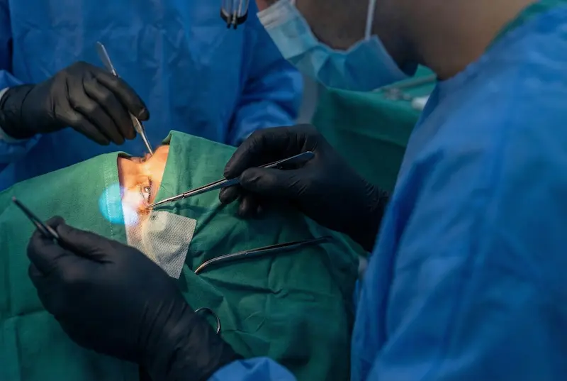 Close-up of surgeons performing delicate eyelid surgery with microsurgical instruments in a modern operating room, illustrating the question “Is Plastic Surgery In Turkey Safe?”.