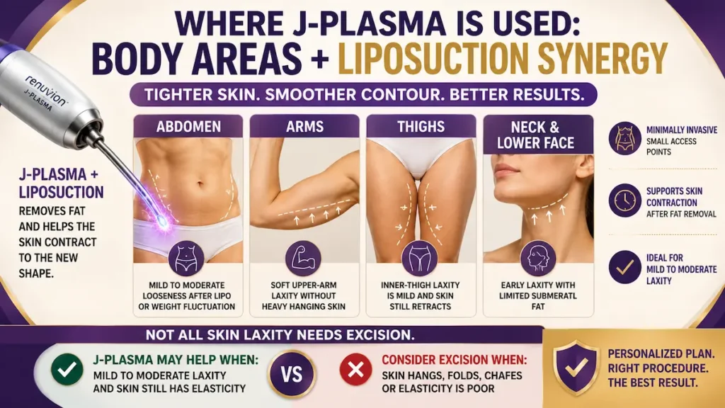 J-Plasma liposuction skin tightening infographic showing abdomen, arms, thighs, and neck treatment areas.