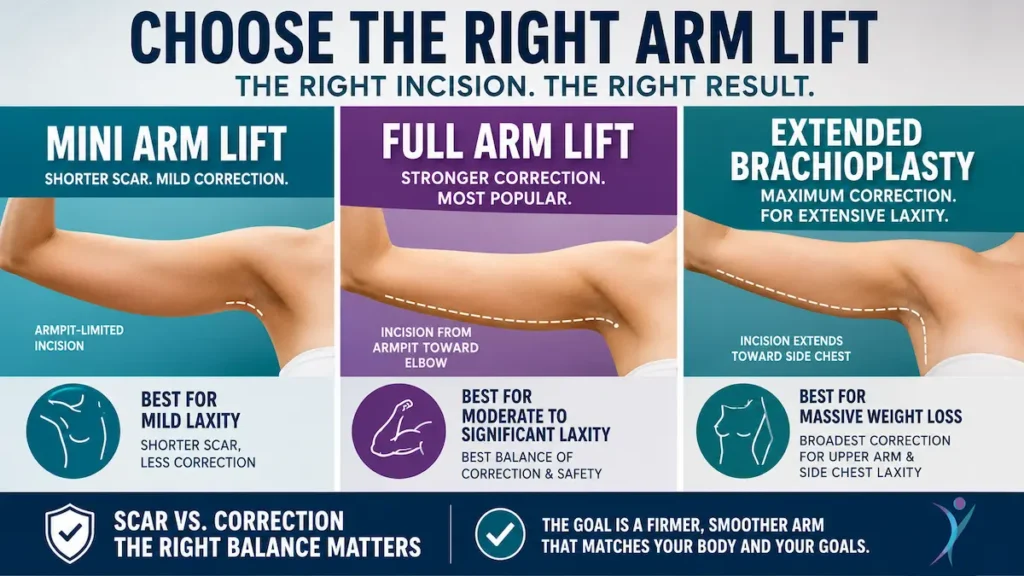 Mini vs full vs extended arm lift infographic comparing scar length, correction level, and best candidates.
