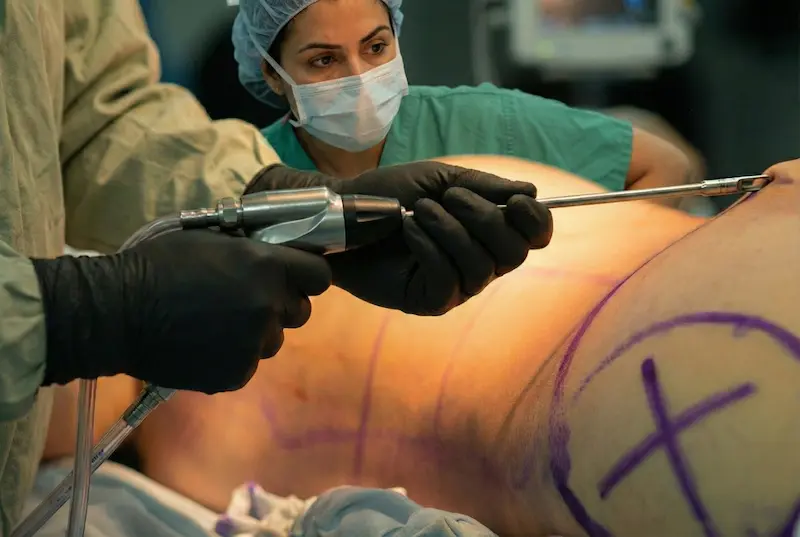 Surgeons in full protective gear performing an operation in a sterile, modern theatre at the safest plastic surgery clinic in Turkey.