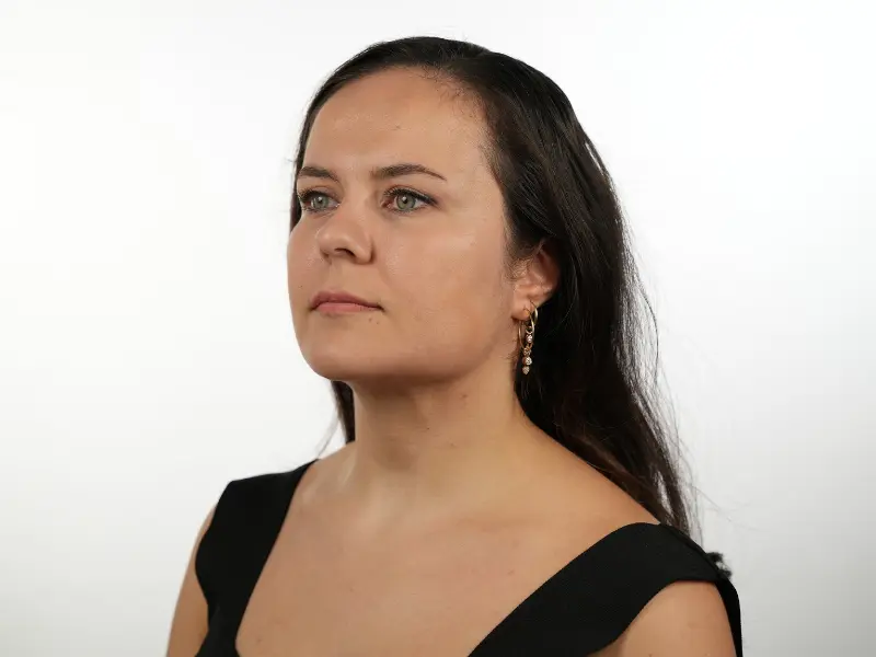 SMAS Facelift in Turkey - Post-operative view of a female patient showcasing a defined jawline and natural ear contours following a deep tissue facial procedure.
