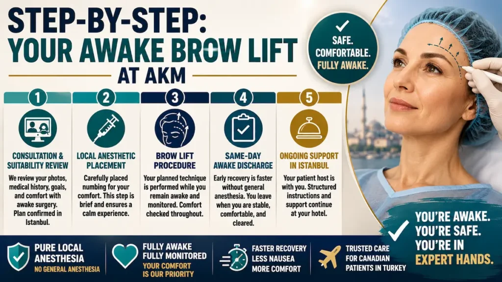Awake brow lift step-by-step infographic showing consultation, local anesthetic placement, brow lift procedure, same-day discharge, and support in Istanbul.