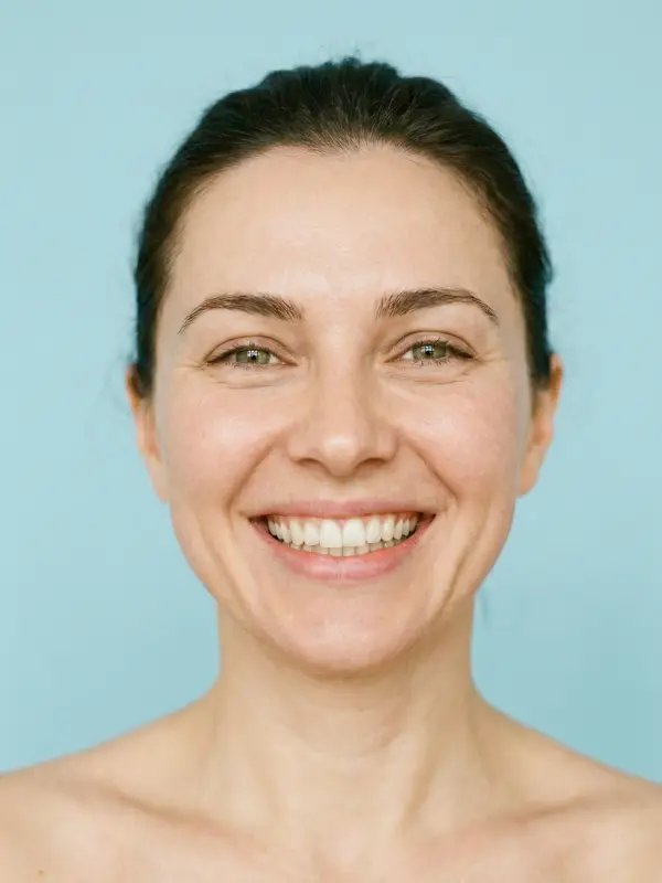 Natural looking result of Deep Plane Facelift, Neck Lift and Fractional Laser package at AKM Clinic Turkey showing glowing skin texture and defined jawline