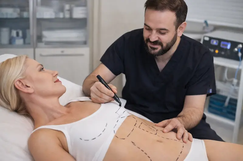 How lipo 360 is planned and performed: surgeon marks treatment areas on patient’s abdomen during pre-op consultation for full-trunk contouring.
