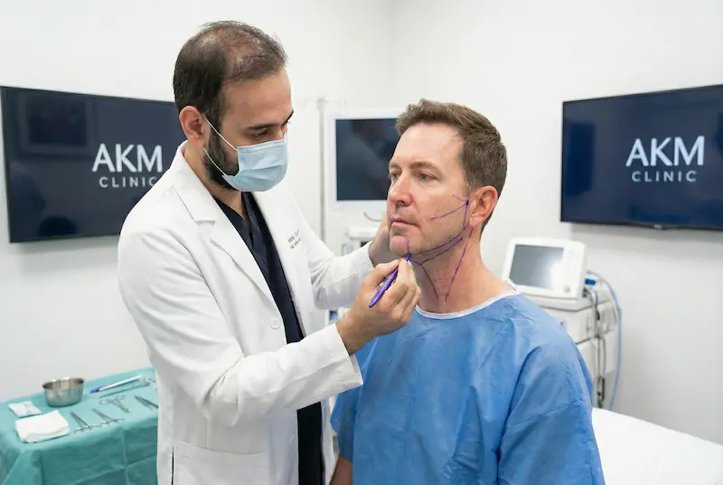 AKM Clinic consultation photo showing a surgeon marking facelift vectors on a male patient to avoid a pulled or feminized look and preserve masculine contours.