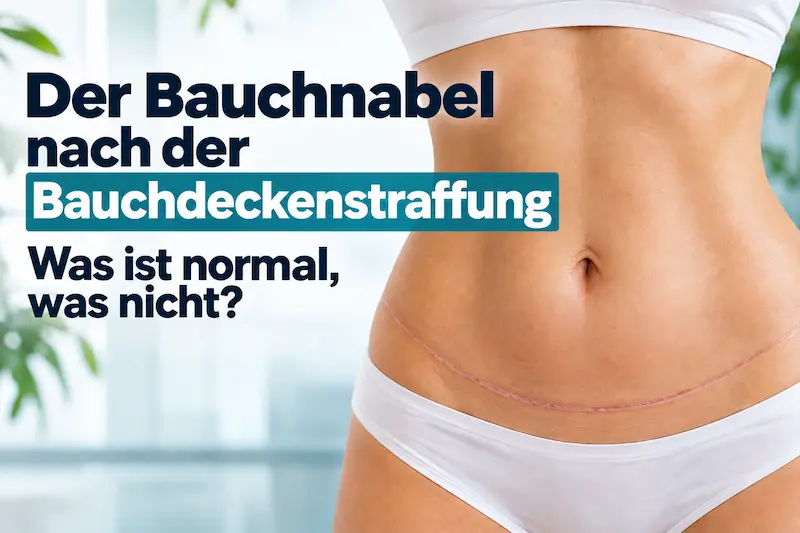 Titelbild mit verheilter Bauchdecke, Narbe und Text zum Bauchnabel nach Bauchdeckenstraffung.