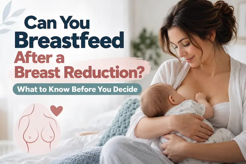 Mother breastfeeding her baby with guide text on breastfeeding after breast reduction and planning breast surgery.
