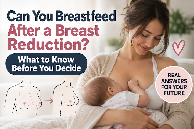 Mother nursing her baby beside a breast surgery diagram for breastfeeding after breast reduction education.